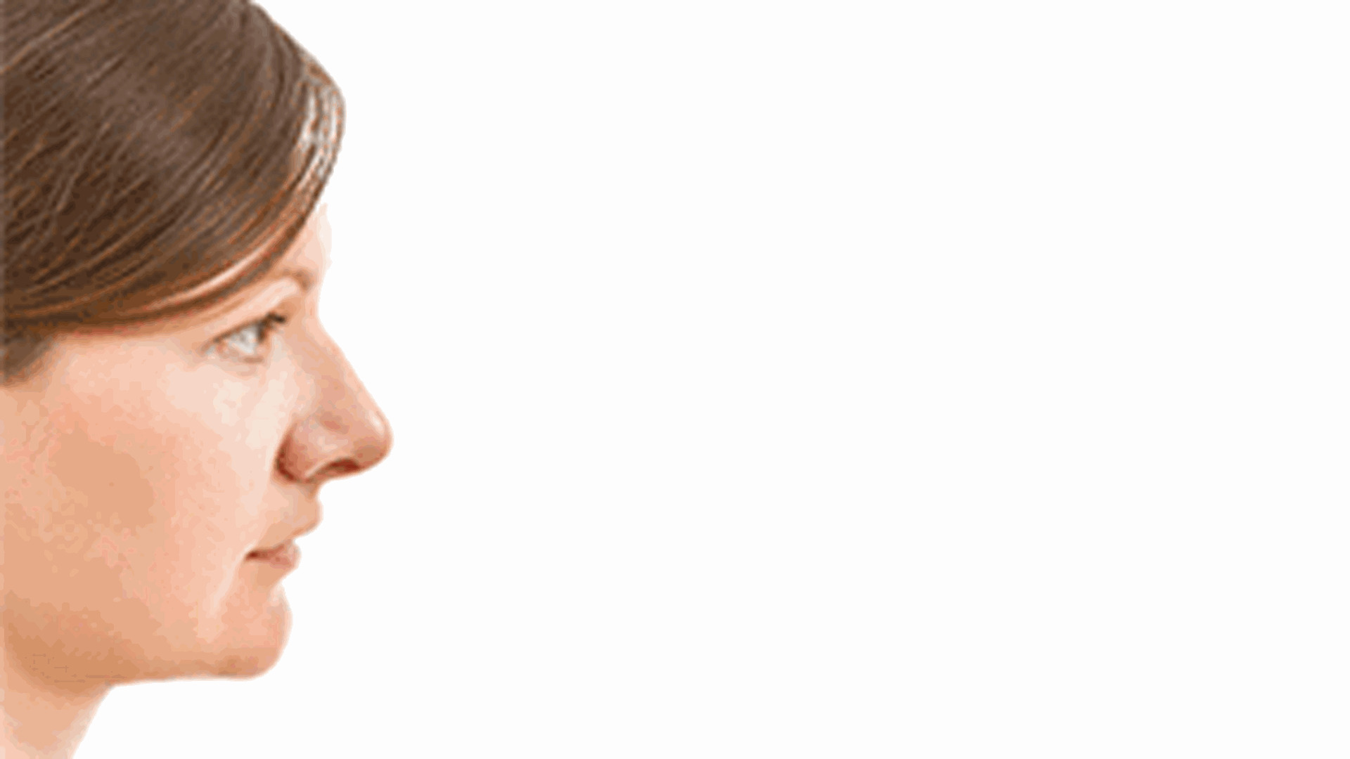 임플란트가 중요한 이유 – 자연치아가 손실되면 얼굴 형태 변화가 생긴다. 턱뼈의 퇴화는 얼굴 피부가 뼈 위로 “처지는” 현상을 야기합니다. 이로 인해 더 많은 주름이 생기고 실제 나이보다 더 늙어 보이게 됩니다. 임플란트가 중요한 이유 - 자연치아가 손실되면 턱뼈 손실이 일어난다. 치아가 빠지면 해당 부위의 턱뼈가 자극을 받지 못해 서서히 녹아내립니다. 씹는 압력이 사라지면 뼈 덩어리가 돌이킬 수 없게 줄어듭니다. 이는 얼굴 형태 변화로 이어집니다.