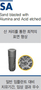 오스템 SA는 임플란트 표면에 작은 입자를 뿌려 표면적을 넓히면서 잇몸 뼈와의 결합을 도와주는 방법인데요. 가장 경제적이라는 장점이 있었어요.  오스템 SA는 임플란트 표면에 작은 입자를 뿌려 표면적을 넓히면서 잇몸 뼈와의 결합을 도와주는 방법인데요. 가장 경제적이라는 장점이 있었어요. 