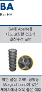 BA는 사람의 뼈를 구성하는 무기질 성분과 동일한 골형성 촉진물질을 10nm이하로 얇게 코팅한 프리미엄 재료로 기존 표면 대비 30% 이상 골유착 성능을 높여 치료기간을 줄여줄 수 있는데요. 단단한 골질부터 약한 골질을 가진 분들 모두 높은 성공률을 기대할 수 있었어요. BA는 사람의 뼈를 구성하는 무기질 성분과 동일한 골형성 촉진물질을 10nm이하로 얇게 코팅한 프리미엄 재료로 기존 표면 대비 30% 이상 골유착 성능을 높여 치료기간을 줄여줄 수 있는데요. 단단한 골질부터 약한 골질을 가진 분들 모두 높은 성공률을 기대할 수 있었어요.