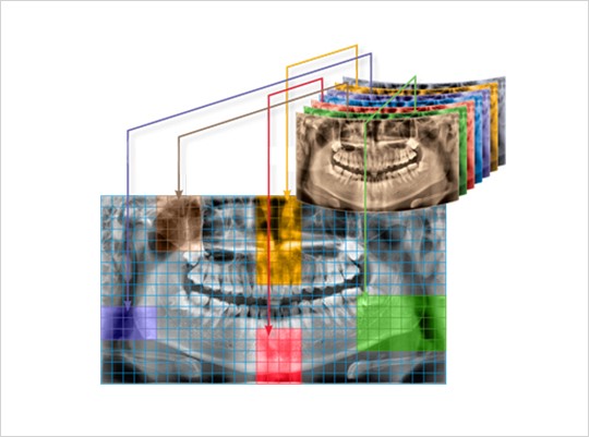 울산 남구치과의 첨단 3D CT 스캔 기술을 이용한 임플란트 상담 장면