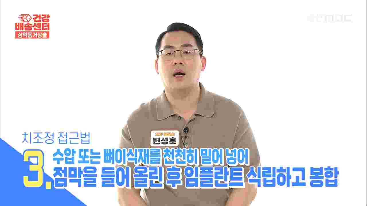 상악동 거상술의 정석, 울산임플란트 변성훈 원장