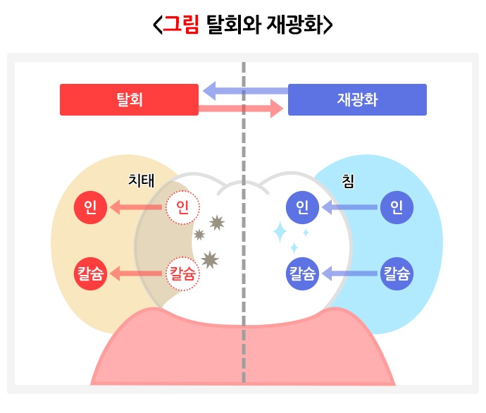 불소_드림연합치과 (3)