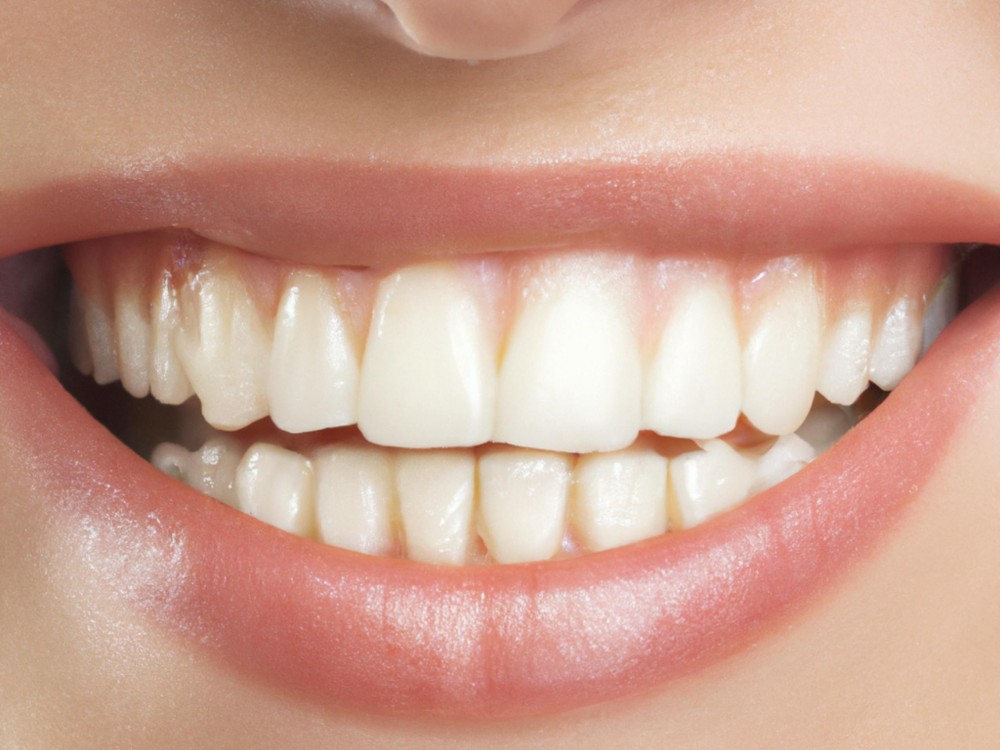 pexels-kasim-h-472764614-16212691 건강한 건치와 잇몸을 들어내고 웃고 있는 잇몸약 효과는 별도로 없다는 것을 알려주는 환자