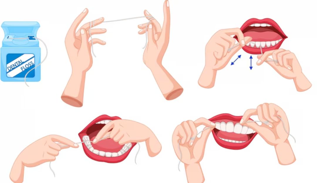 치실사용법 (6) 치실 사용법 단계별 사진