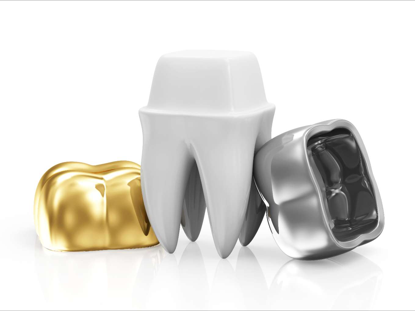 dental-crowns-with-tooth-isolated 골드 인레이/온레이 사진