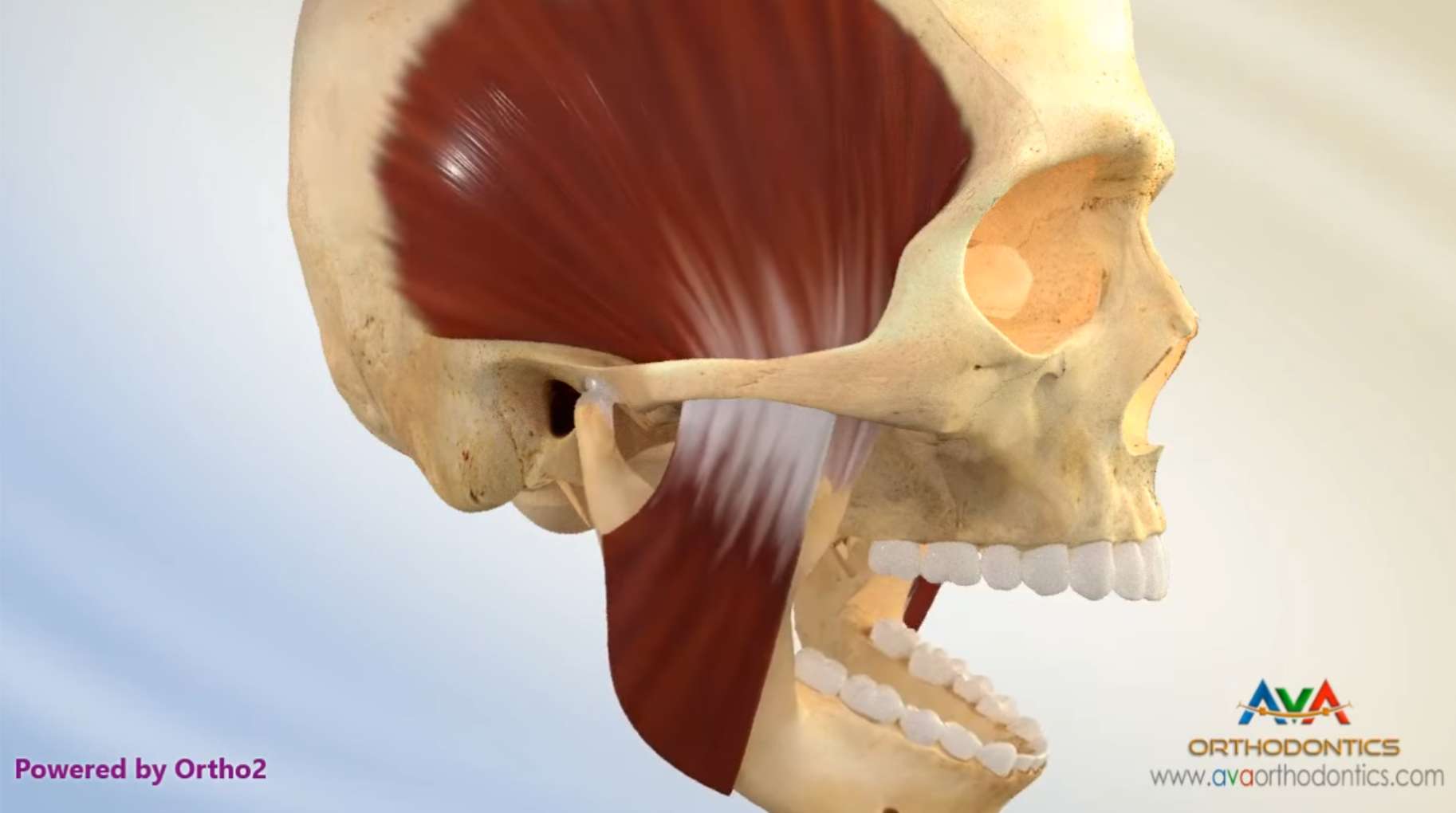 입을 벌릴떄 부정교합이 생겨서 TMJ가 생김