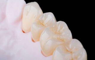 브릿지 하방 모형사진