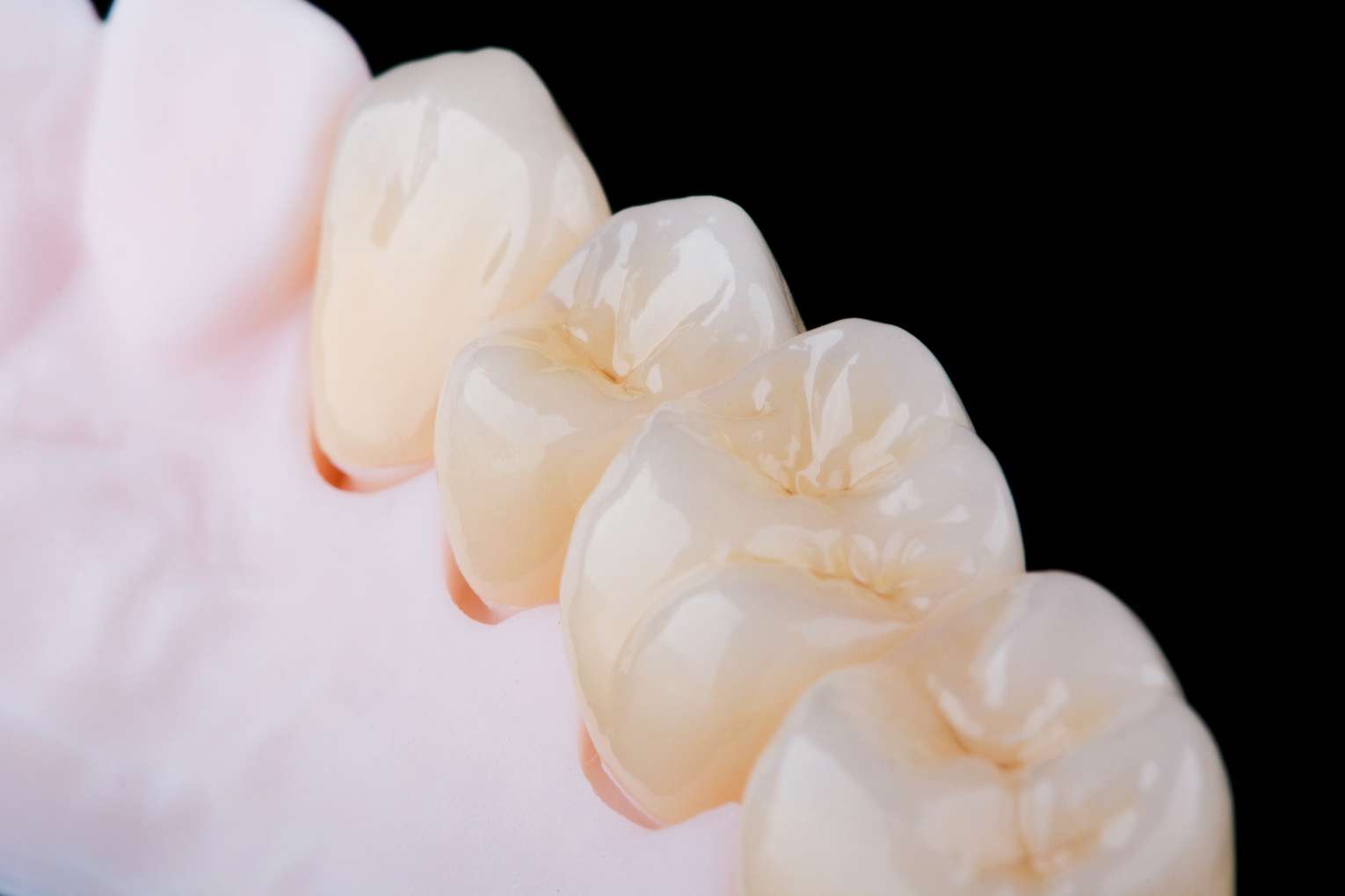 브릿지 하방 모형사진