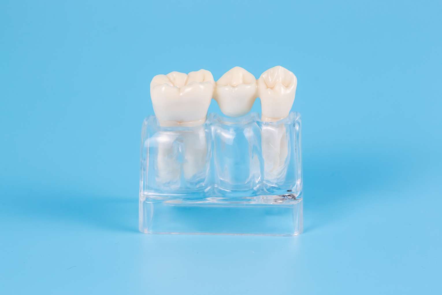 plastic-dental-crowns-imitation-dental-prosthesis-dental-bridge-one-tooth