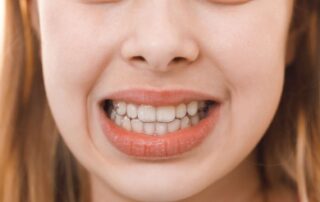 이를 악물었을 때 보이는 투명한 치아.