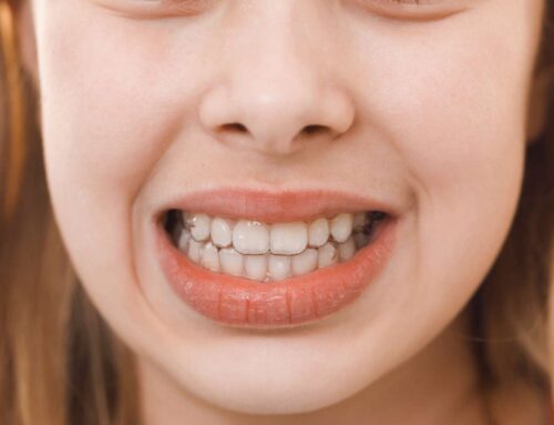 울산 투명한 치아 | 앞니 끝이 투명? 법랑질 부식 신호! (드림연합치과)