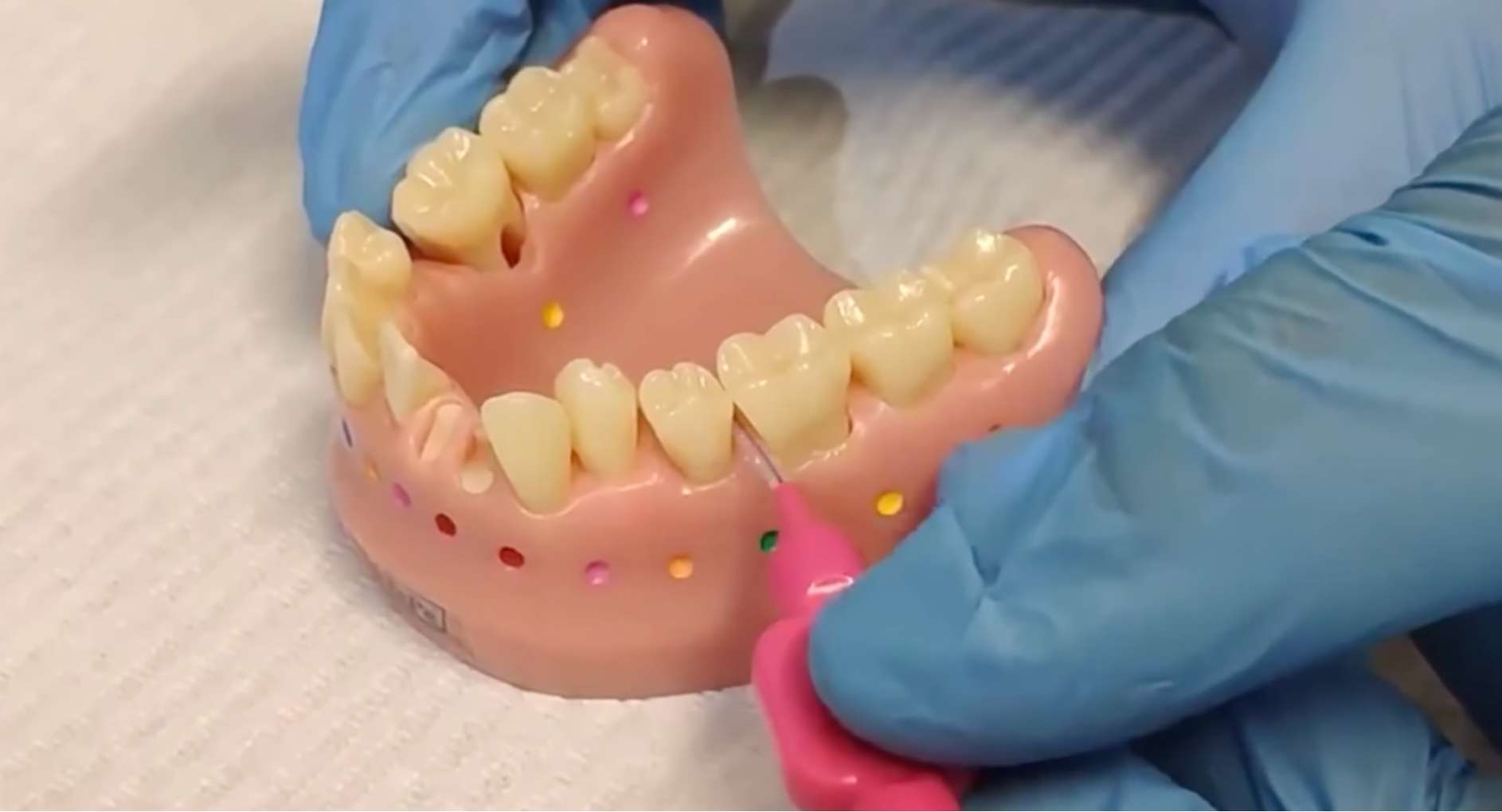 치간칫솔1 치아 모형을 이용한 앞니 치간칫솔 사용 시범, 좁은 잇몸 틈새 이물질 제거, 드림연합치과 구강 관리 교육