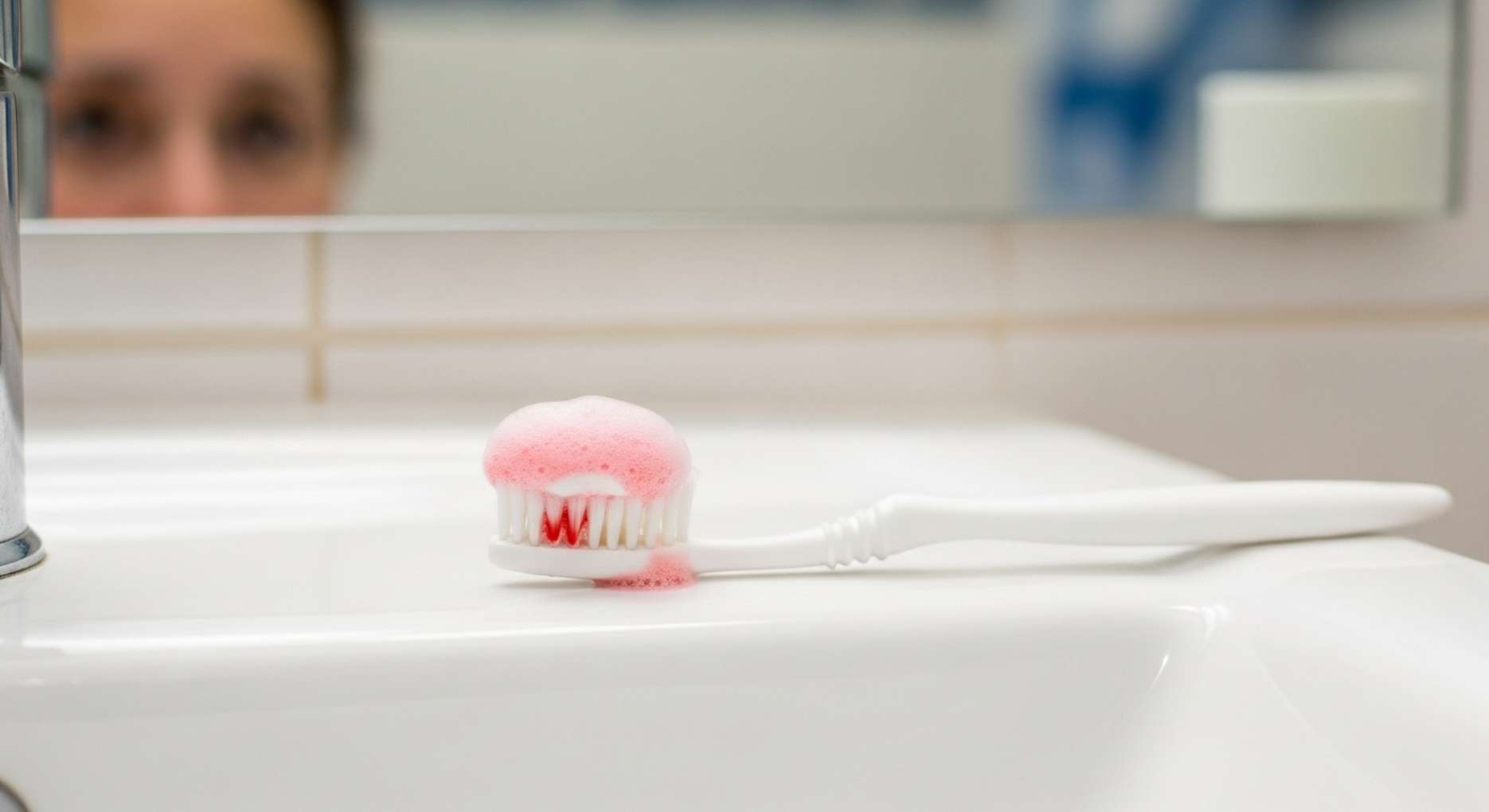 풍치6 양치할 때마다 피가 나는 잇몸 염증 증상 (풍치 초기 신호)