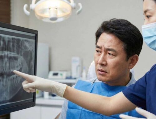 [울산 임플란트] 위턱 뼈가 부족할 때 고려하는 상악동거상술: 측방 접근 vs 치조정 접근 비교 정리 2026