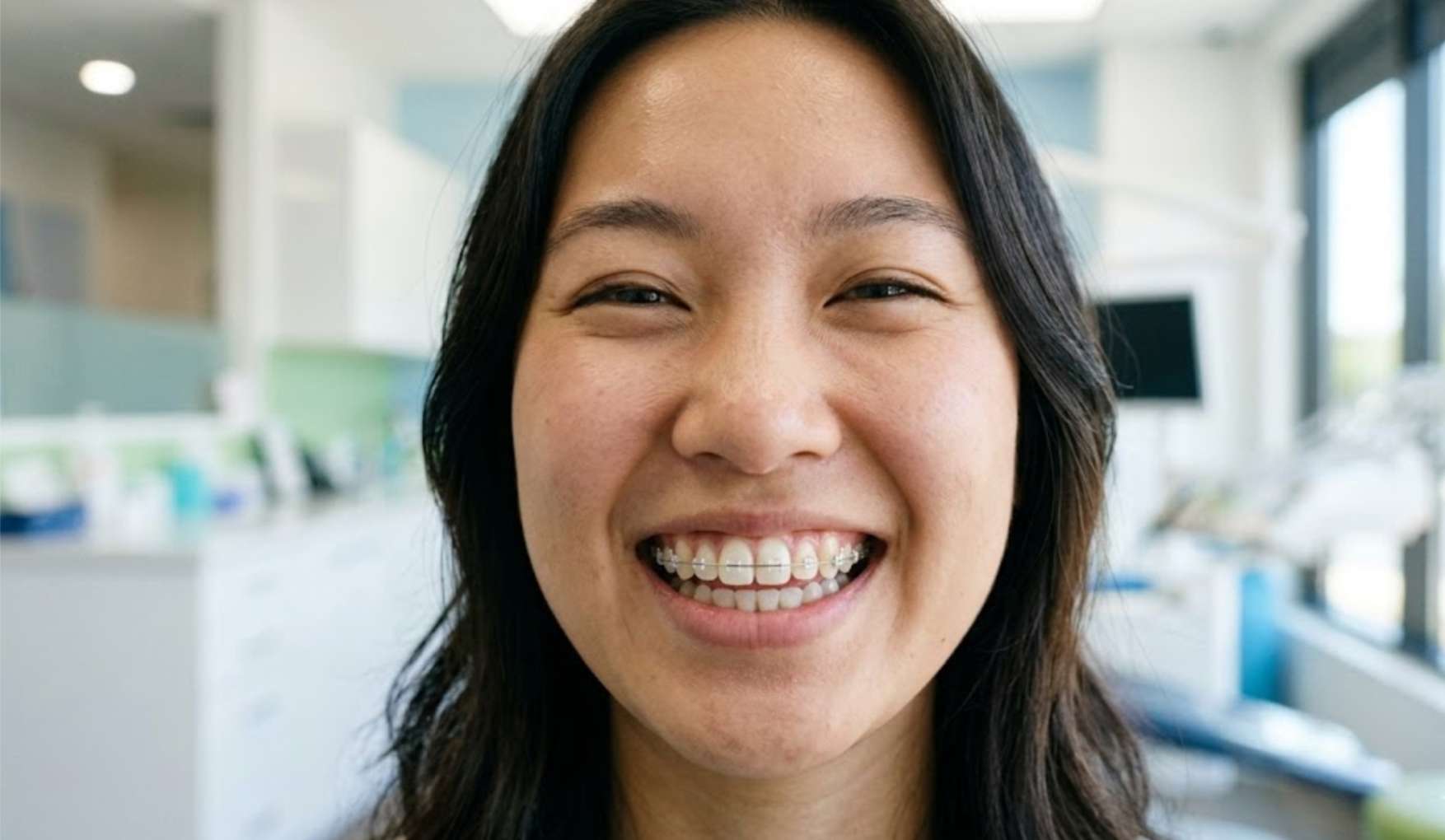 앞니부분교정4 앞니 부분 교정 장치를 착용하고 환하게 웃는 여성