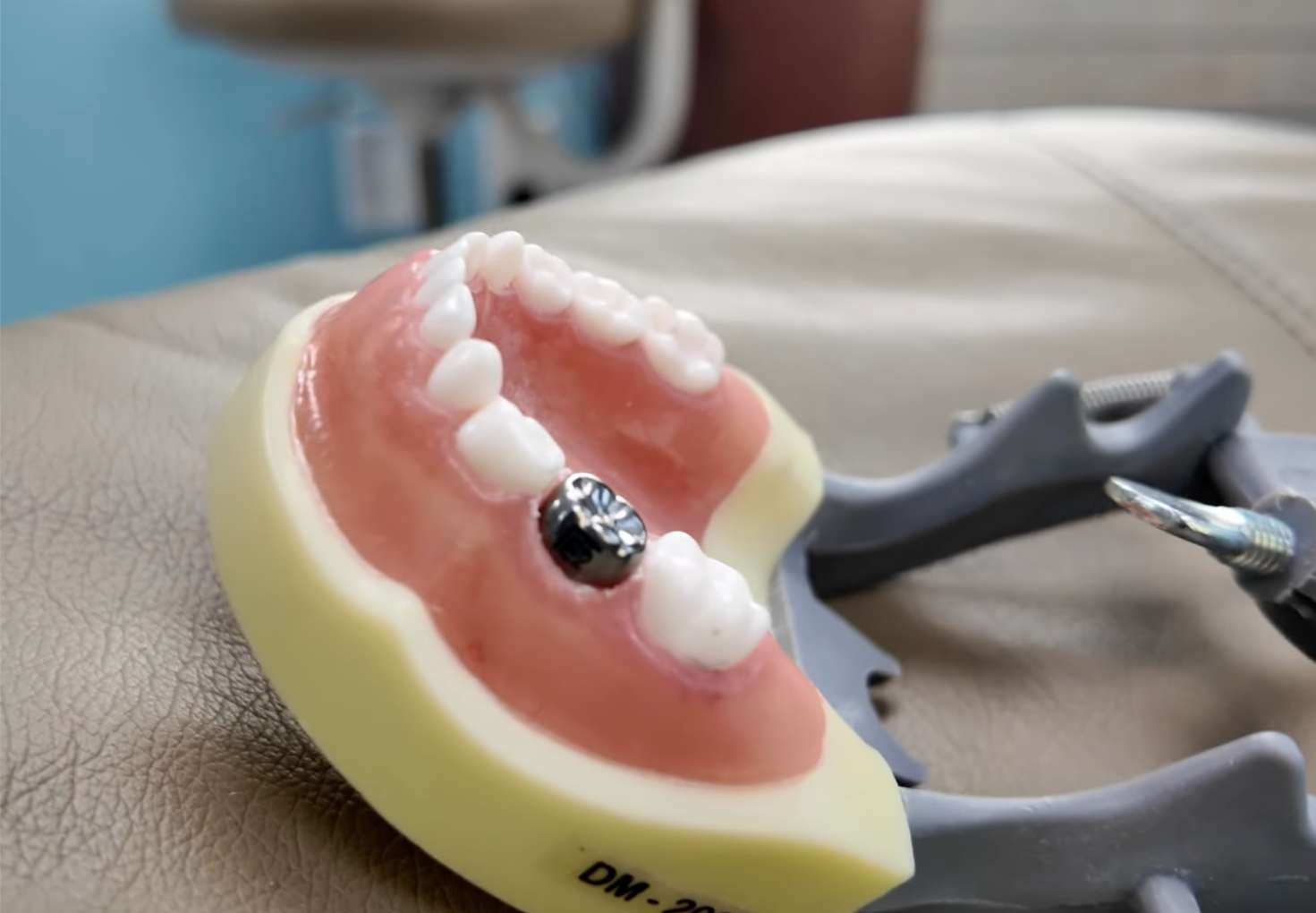 유치관리2 심한 충치 치료 후 은니(SS크라운)를 씌운 치아 모형