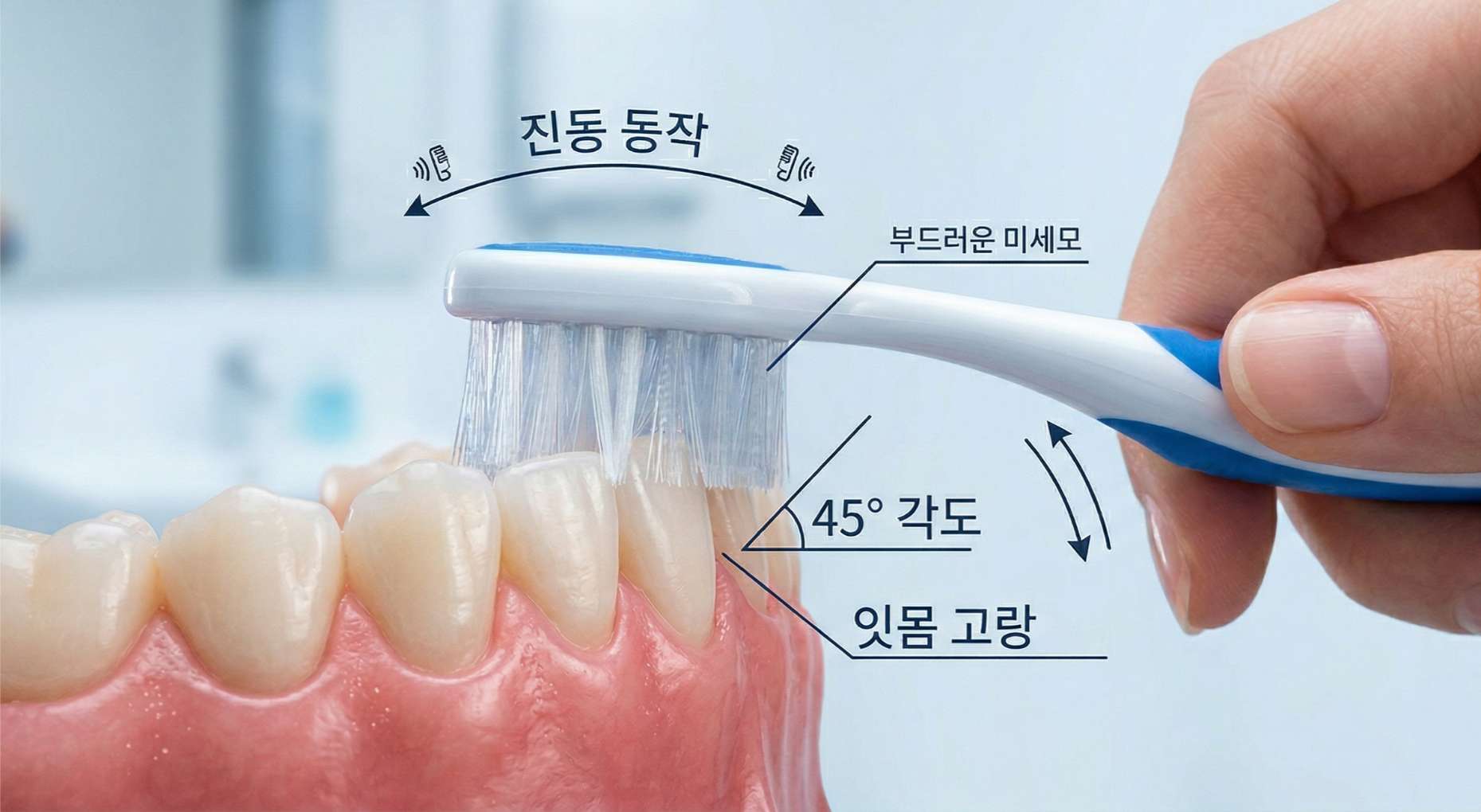 면역력저하성 치은염12 치아와 잇몸 경계 사이에 칫솔모를 45도 각도로 밀착시켜 진동을 주는 양치법을 설명하는 교육용 이미지. '진동 동작', '부드러운 미세모', '45° 각도', '잇몸 고랑' 등의 한글 안내 텍스트가 포함되어 있습니다.