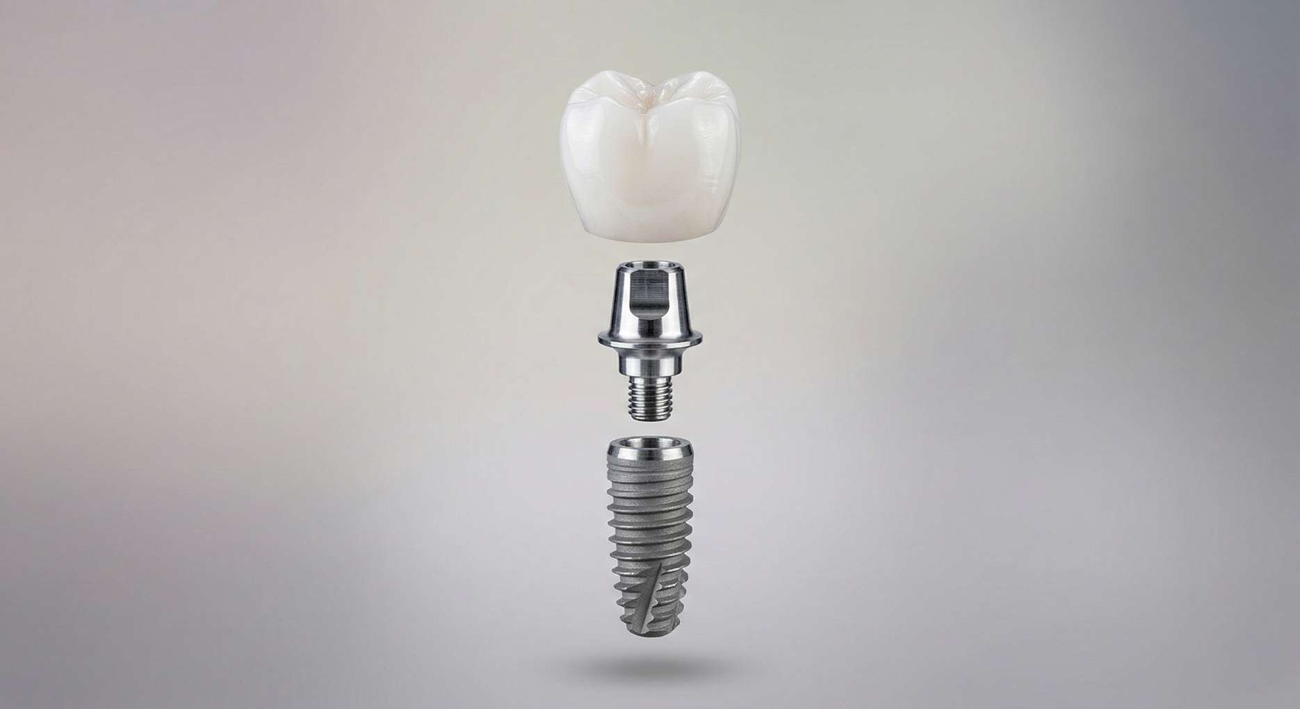 임플란트 2차 수술6 임플란트 픽스처, 지대주, 크라운 보철물의 3단 조립 구조도