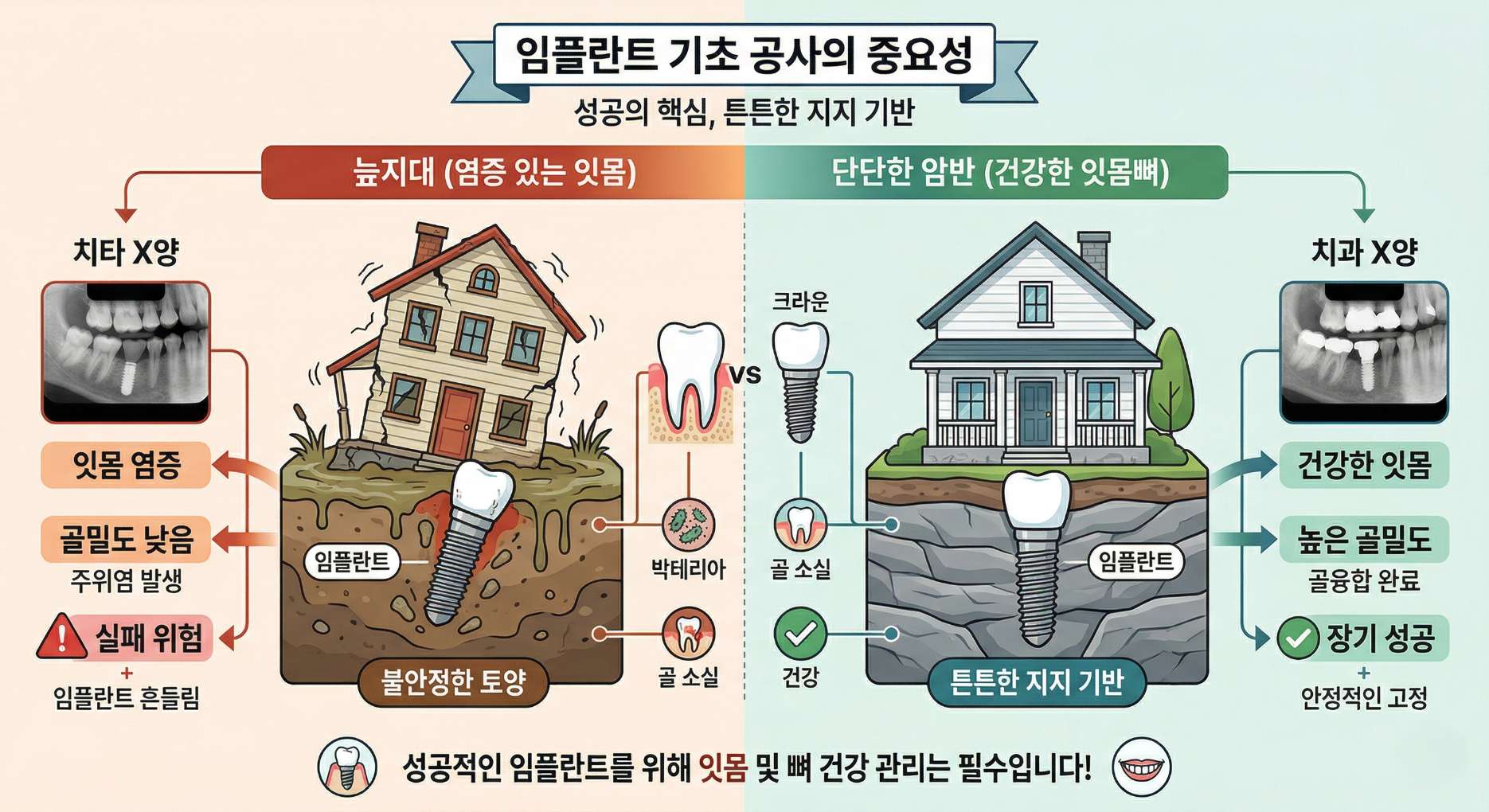 임플란트 잇몸치료8 화분의 흙과 나무 모형을 활용해 어르신 환자에게 잇몸뼈와 임플란트의 관계를 토양과 나무에 비유하여 설명하는 치과 의사
