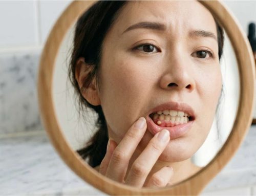 [울산 치과] 잇몸 뾰루지, 피곤해서? 방치하면 안 되는 고름 주머니의 진실