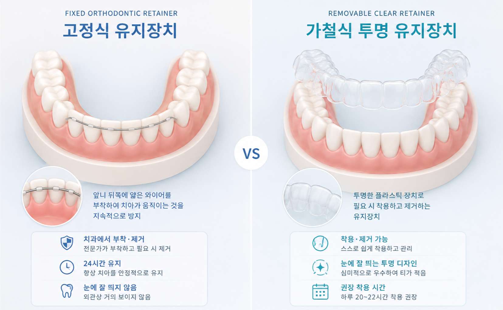 치아 안쪽에 부착하는 고정식 유지장치와 투명하게 탈착할 수 있는 가철식 유지장치를 비교한 3D 일러스트